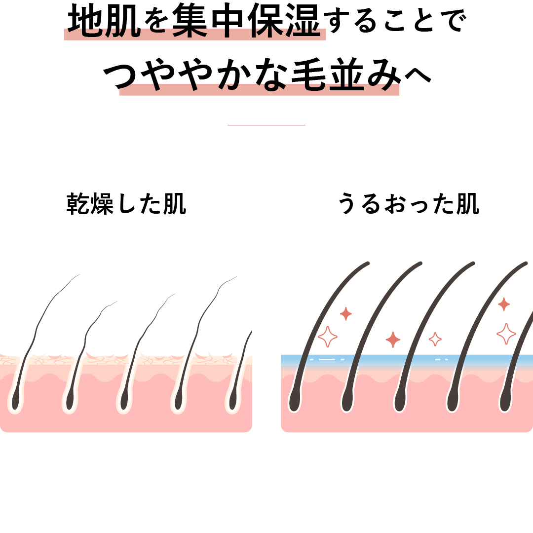 アラダーム ダーム-ワン®