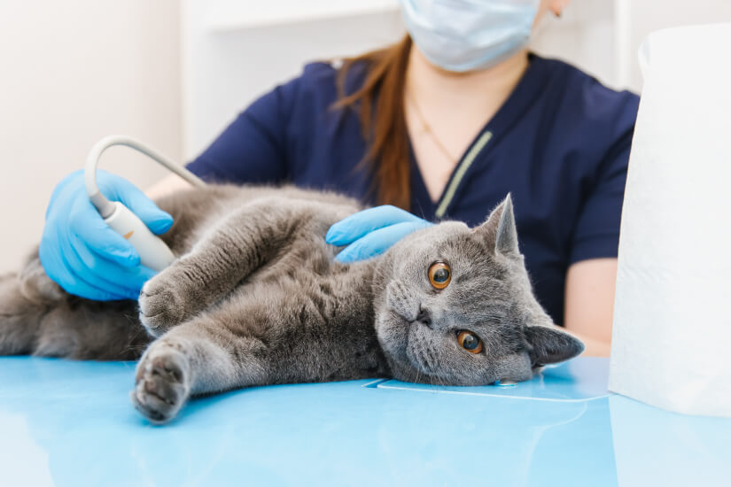 精管切除術に代わる避妊オプション